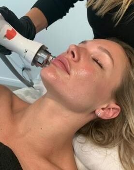 skin-tightening-with-endopulse-in-beaconsfield