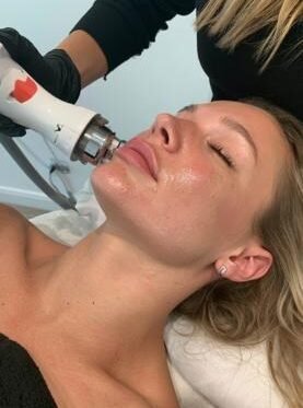 skin-tightening-with-endopulse-in-beaconsfield